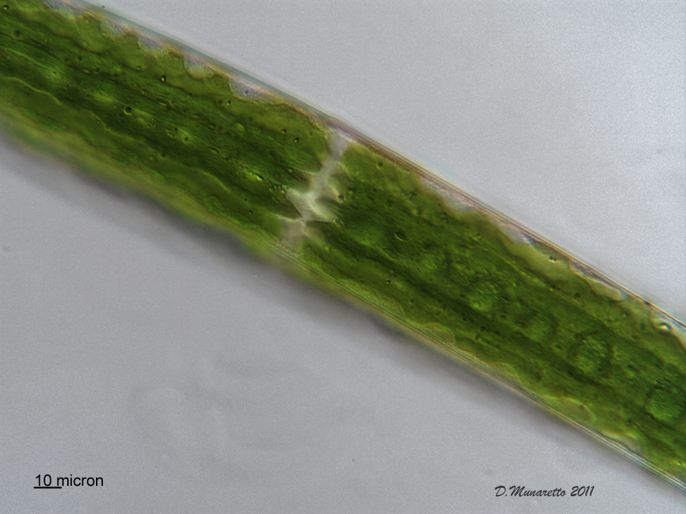 Closterium